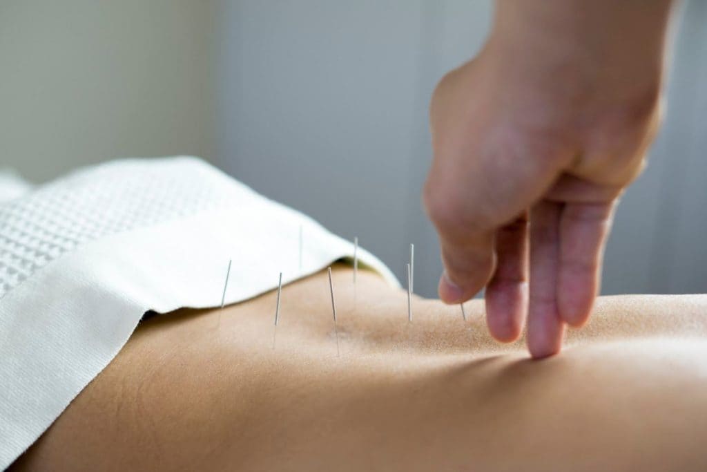 How is acupuncture a good solution to depression?